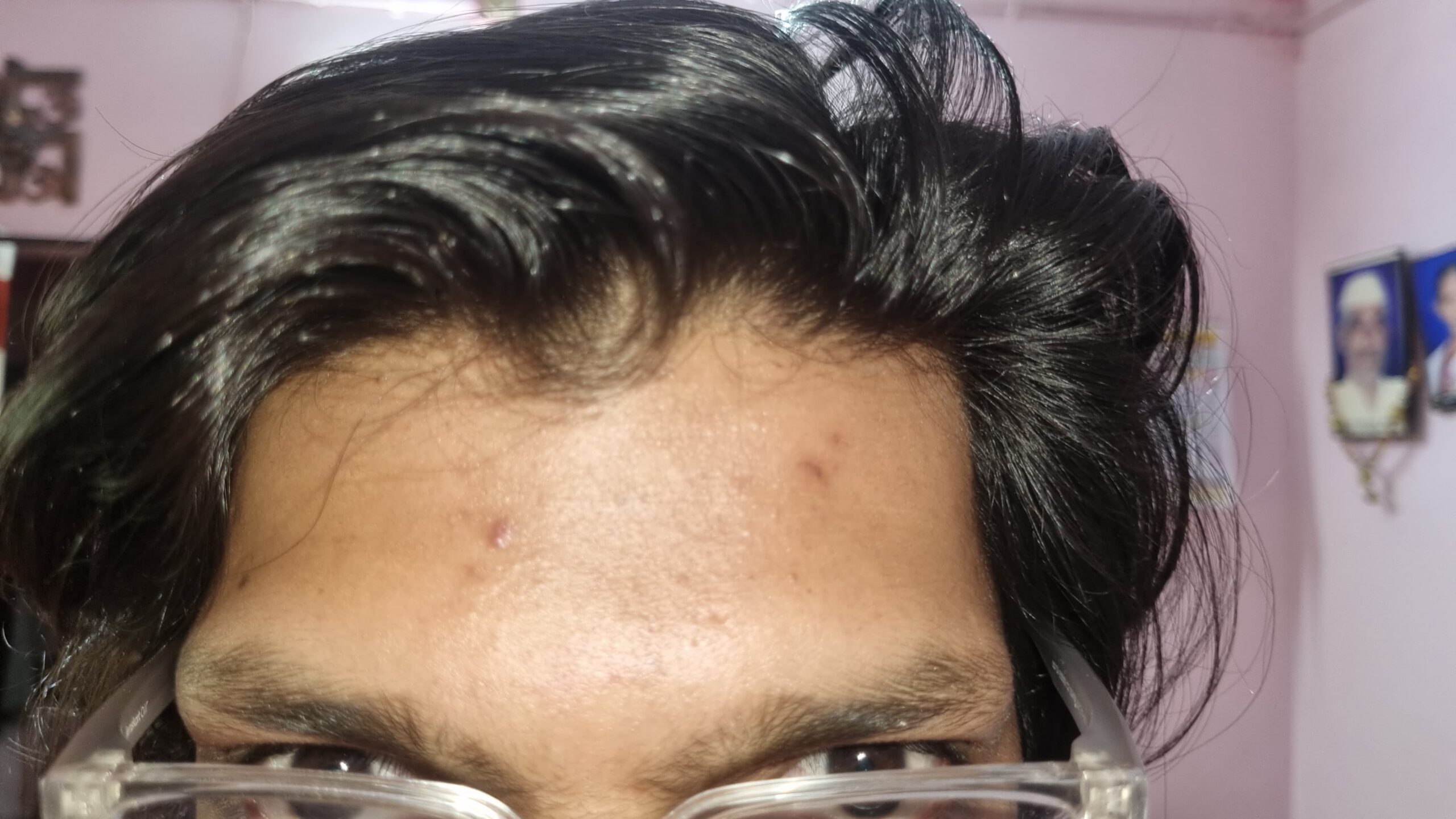 Review photo